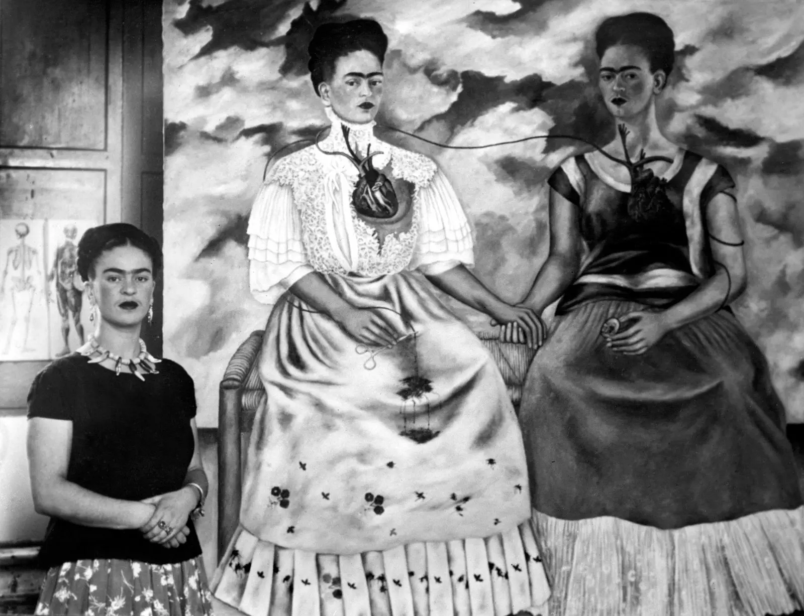 Frida Kahlo